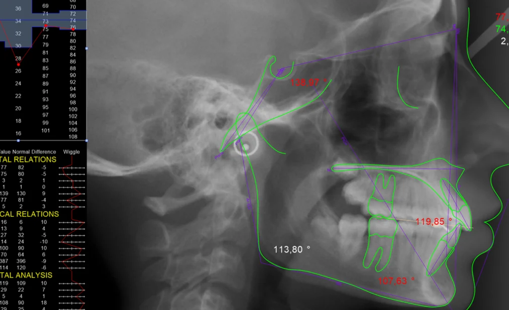 Oral Diagnoz - Radyoloji