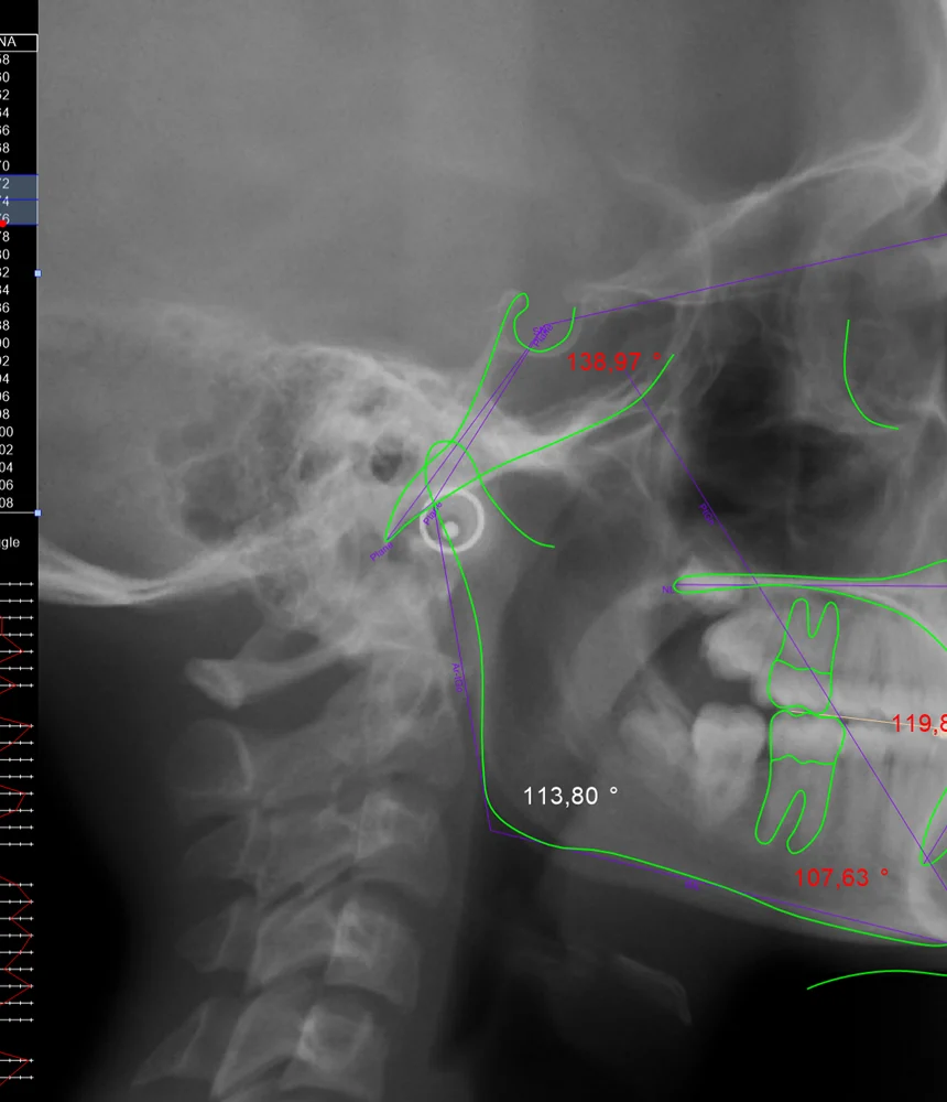 Oral Diagnoz - Radyoloji